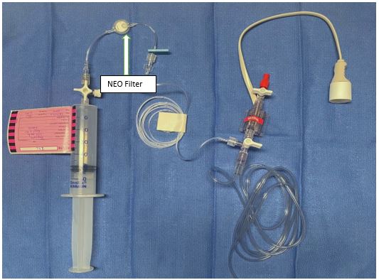 Fig 5 neo filter pressure monitoring